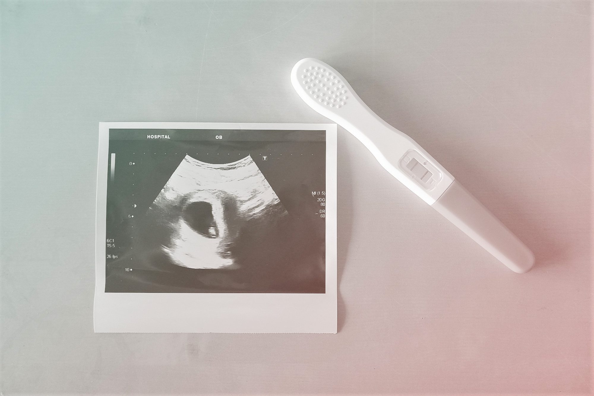 High Angle View Of Ultrasound Photograph By Pregnancy Test On Table